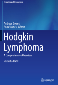 Image of Hodgkin Lymphoma A Comprehensive Overview