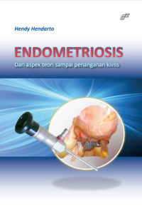 Image of Endometriosis :Dari aspek teori sampai penanganan klinis